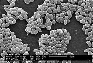 Electron Micrograph of Bacillus anthracis spores. Source